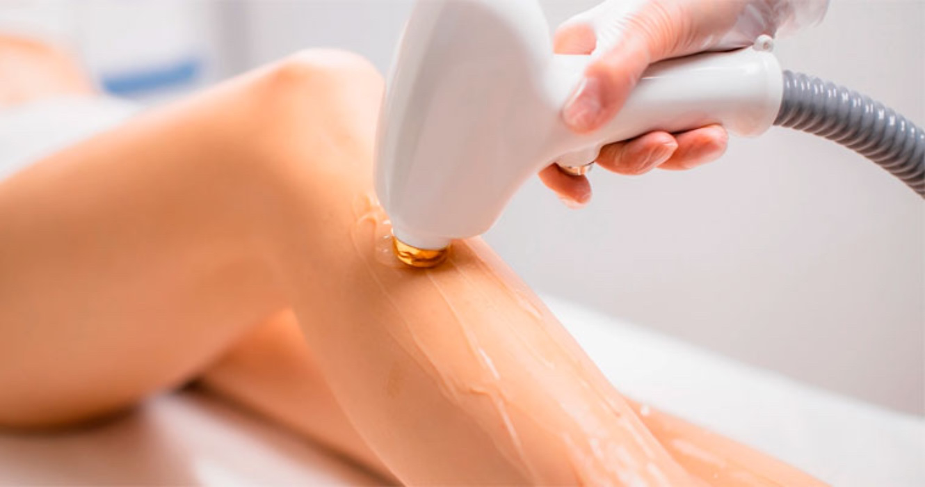 Laser hair removal 6 sesions | Luzely