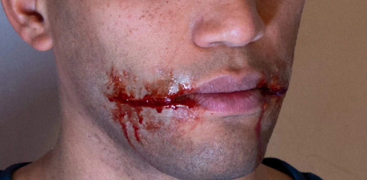 Joker Smile Prosthetics: Unpainted Encapsulated Silicone, Cosplay SFX, horror, prosthetics, larp, comic con, Halloween