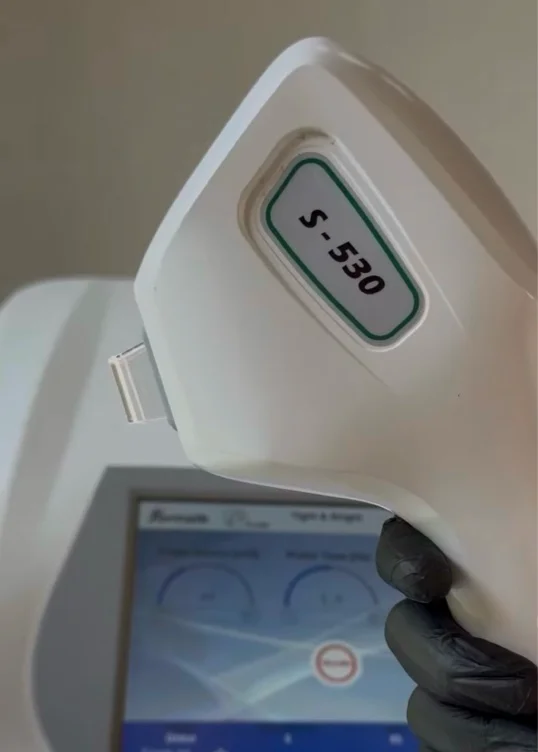 Intimate laser hair removal
