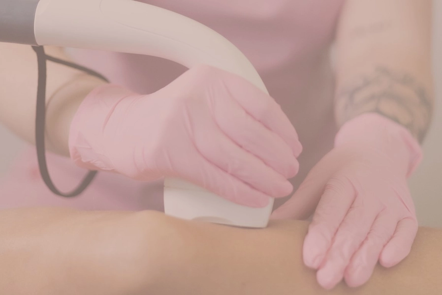 Laser Hair Removal (1 visit)