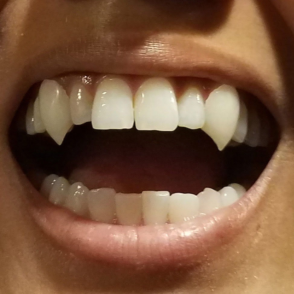 custom fangs 