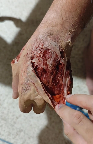 DEGLOVED HAND EFFECT: Ripped Skin Horror Effect