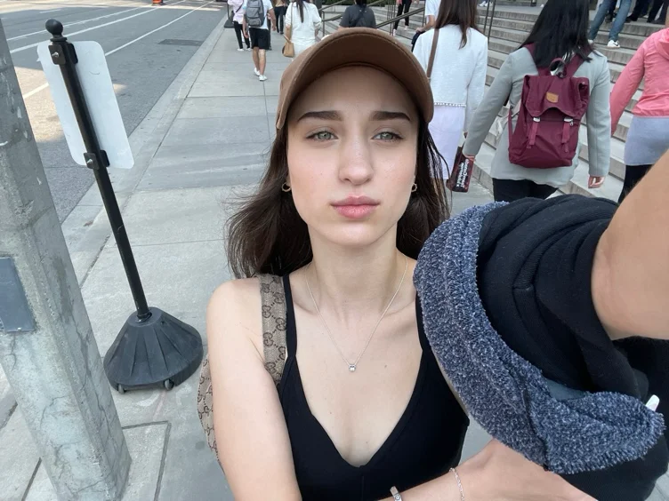 lip filler 