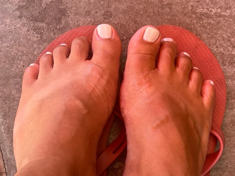 Pedicure