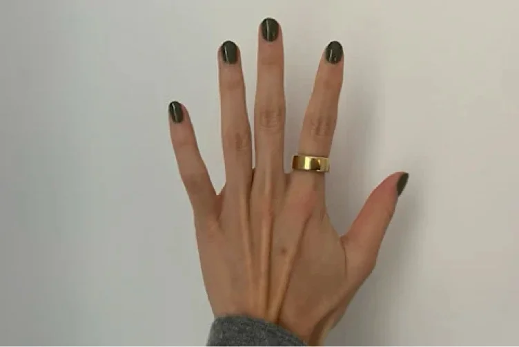 oura ring 💍 