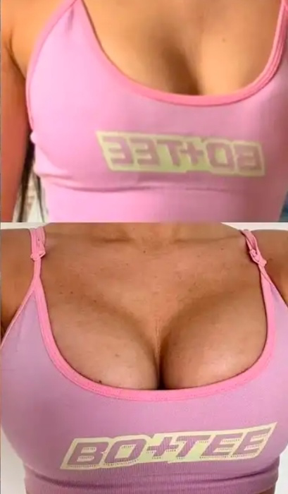 Chest augmentation fund #1