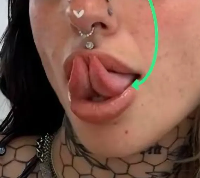 Tongue Splitting