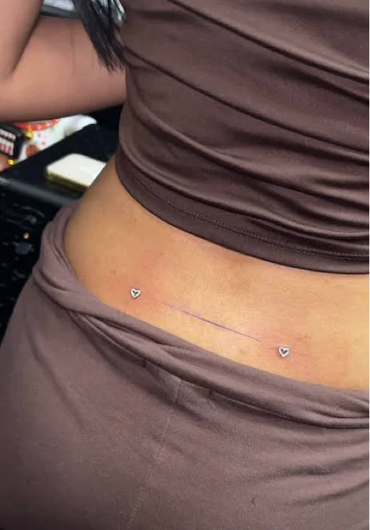 Back dermals (180)