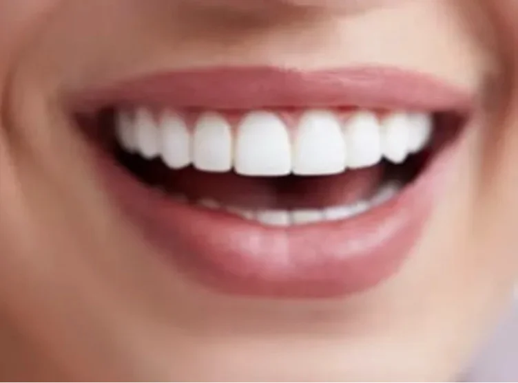 $ 60 | mini dental treatment