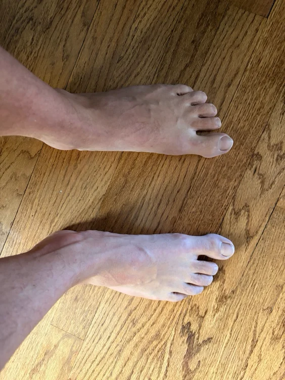 $1 for each toe