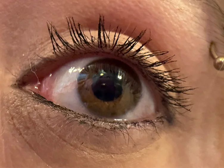 LASIK MD 