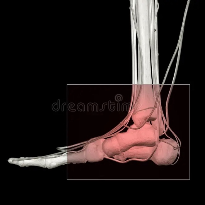 Ankle Surgery Expenses