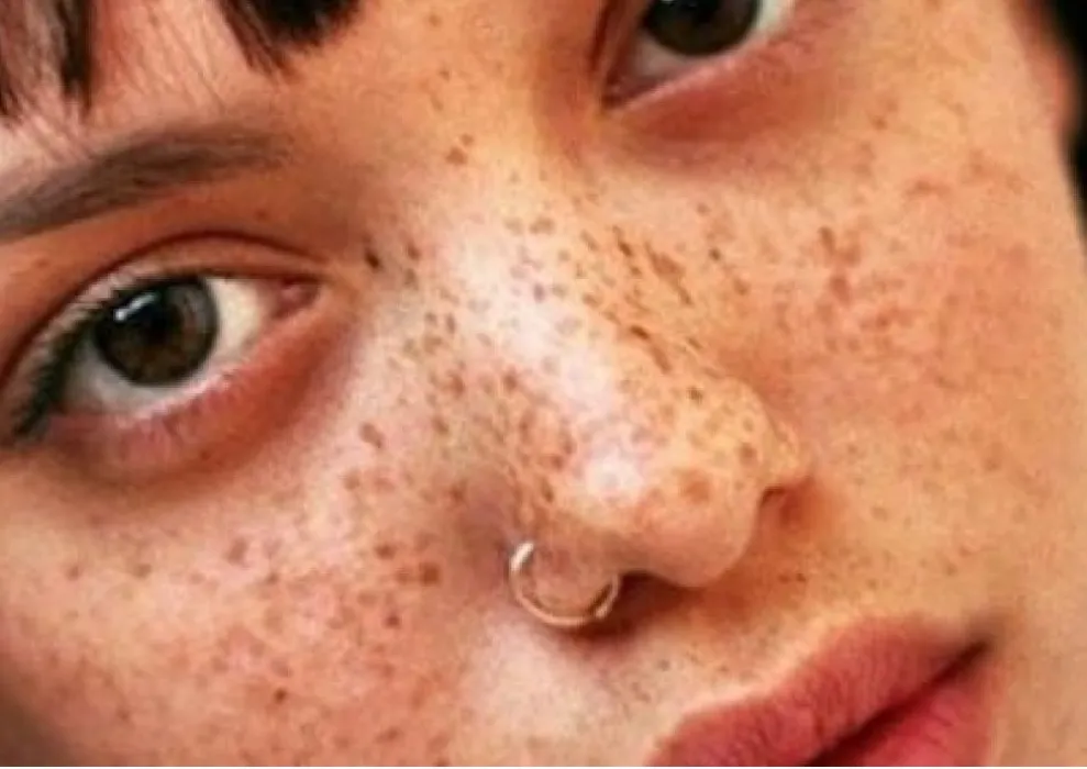 frecklesssss ༶╹ᴗ╹༶ 