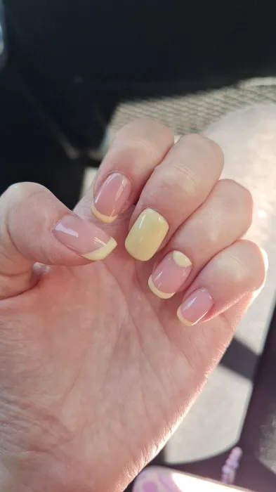 Nails treatment