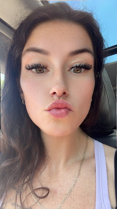 Lip filler 