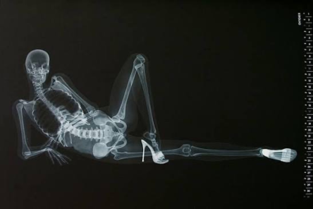 Whole Body MRI