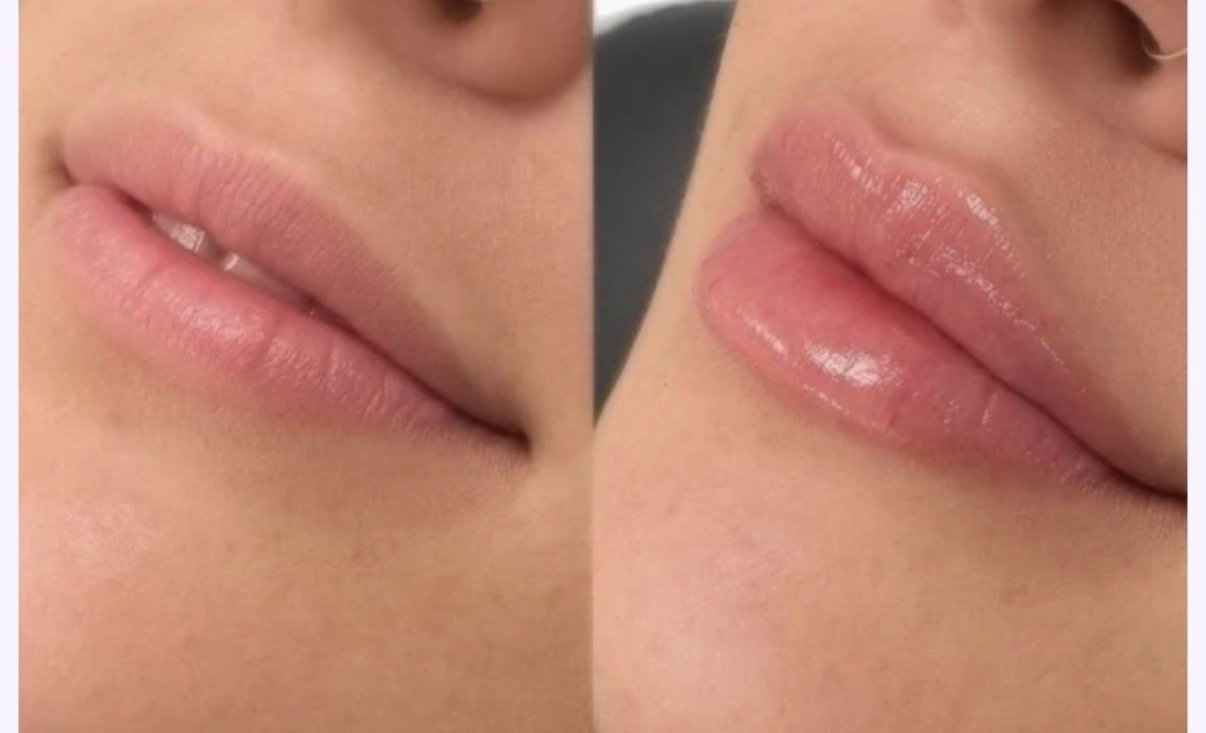 Juicy lips