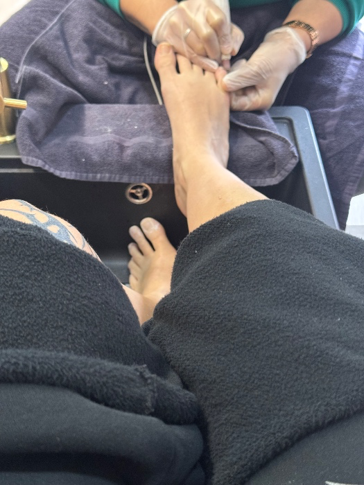 Pedicure