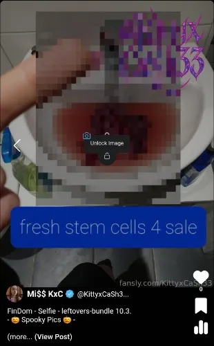 stem cells 4 sale