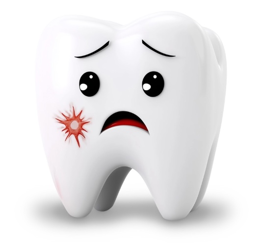 root canal