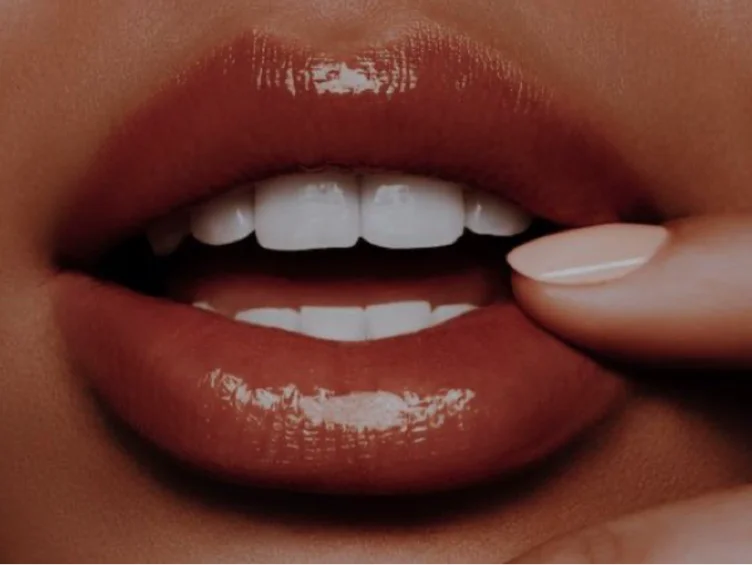 Dream teeth (Invisalign)