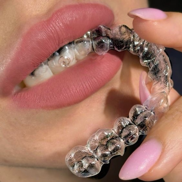 Dental Aligners
