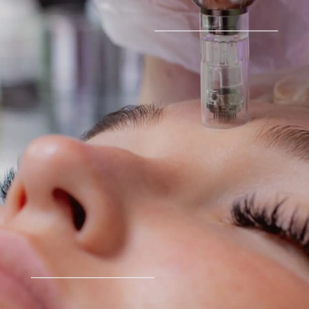 Microneedling Facial Gift