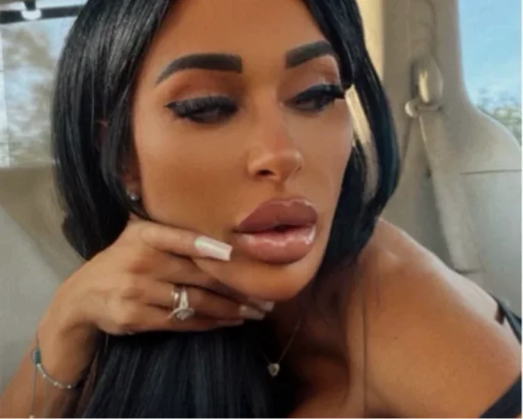 Lips
