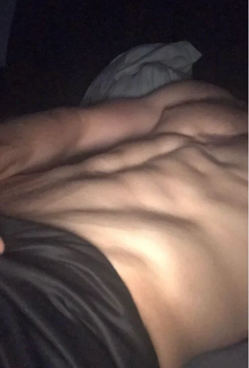 100