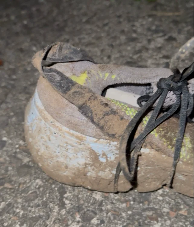 Filthy shoes. 