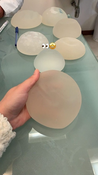 My new boobs