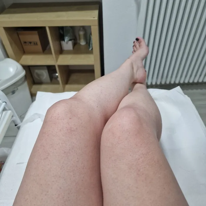 Pedicure
