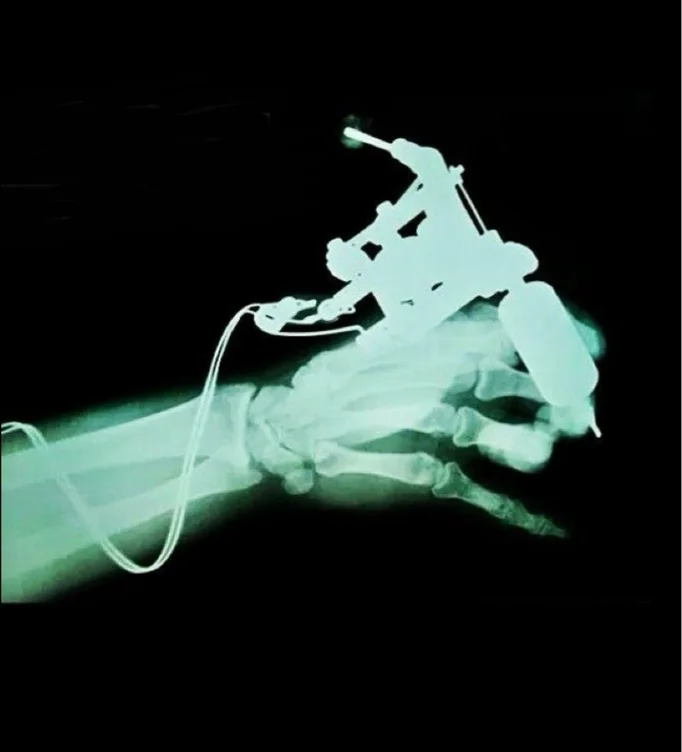 Tattoo gun + supplies