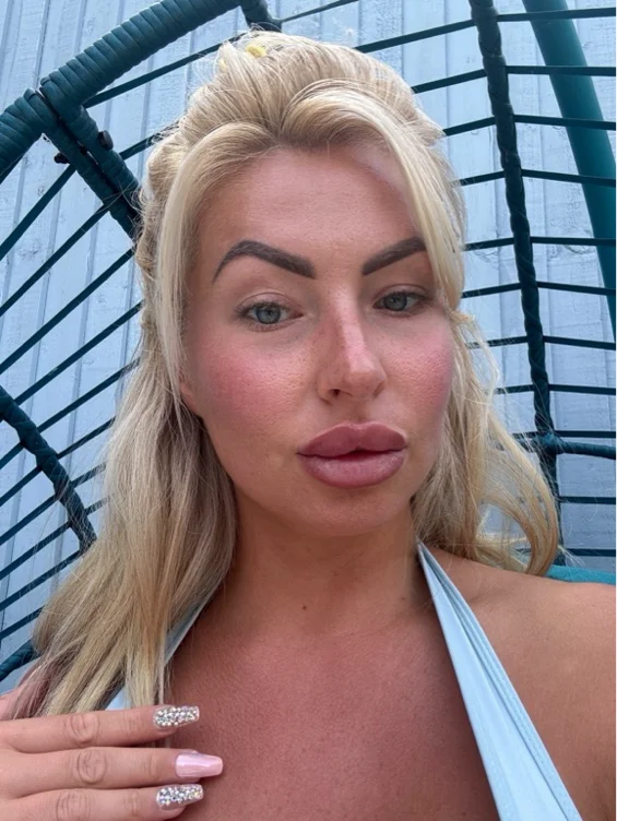 💉 Lip Enhancement Fund 💋