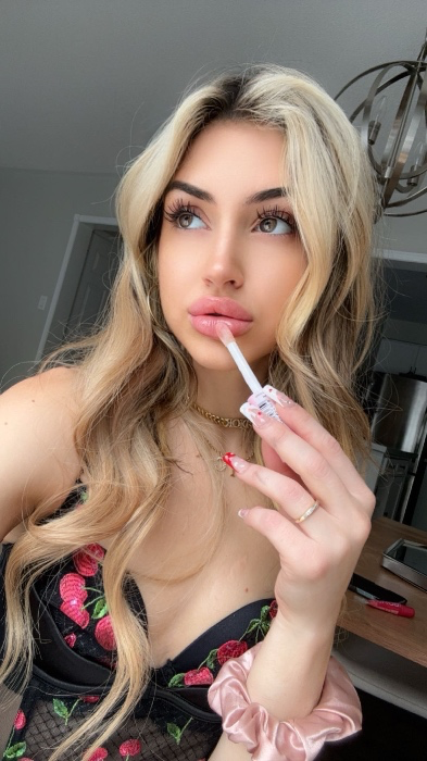 Lip filler 💉