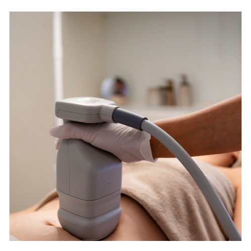 Hifu laserbehandeling buik