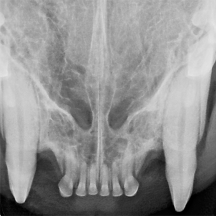 Maui's Upcoming Dental