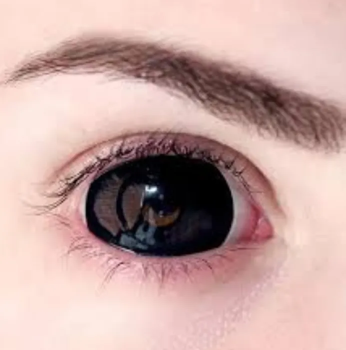 Fund the Eyes of a God Who Sees Your Soul and Finds It Lacking