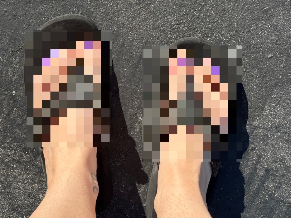 Pedicure