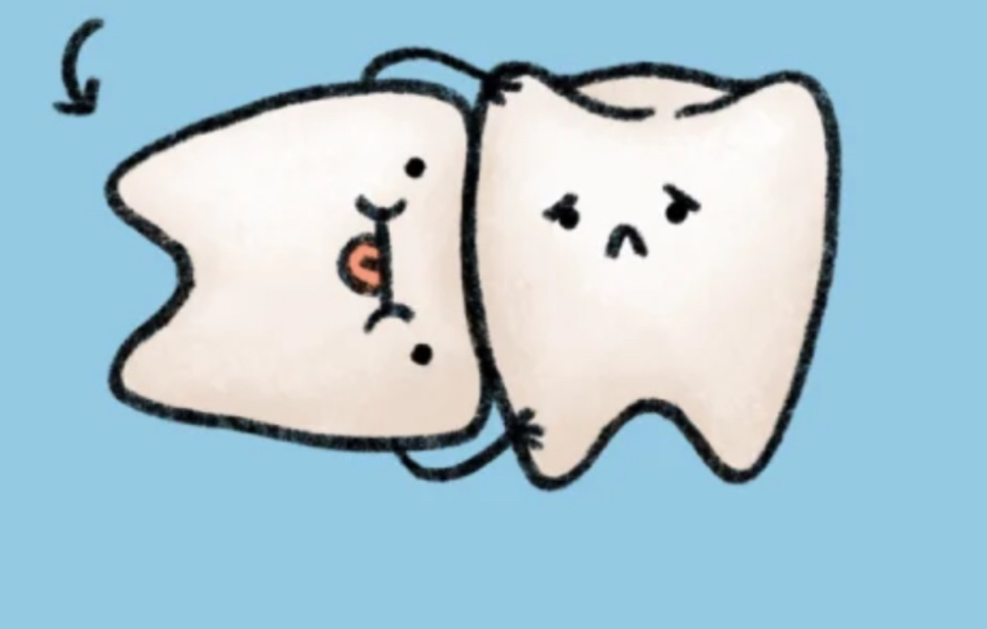 Wisdom tooth goodie package 