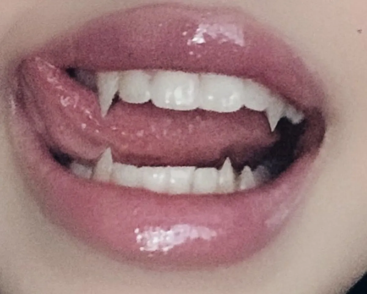 Wisdom teeth removal 