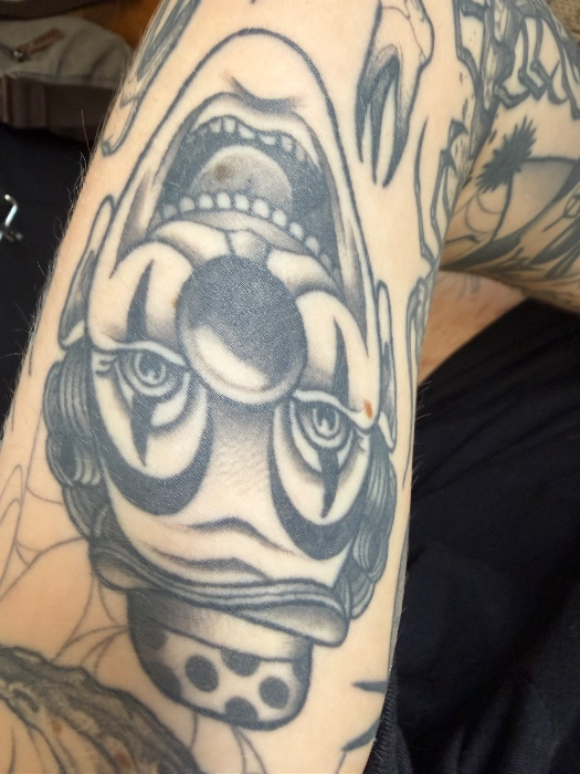 Tattoo laser removal 