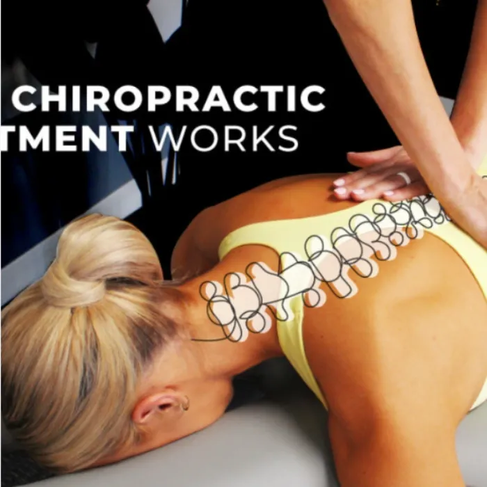 Chiropractic therapy